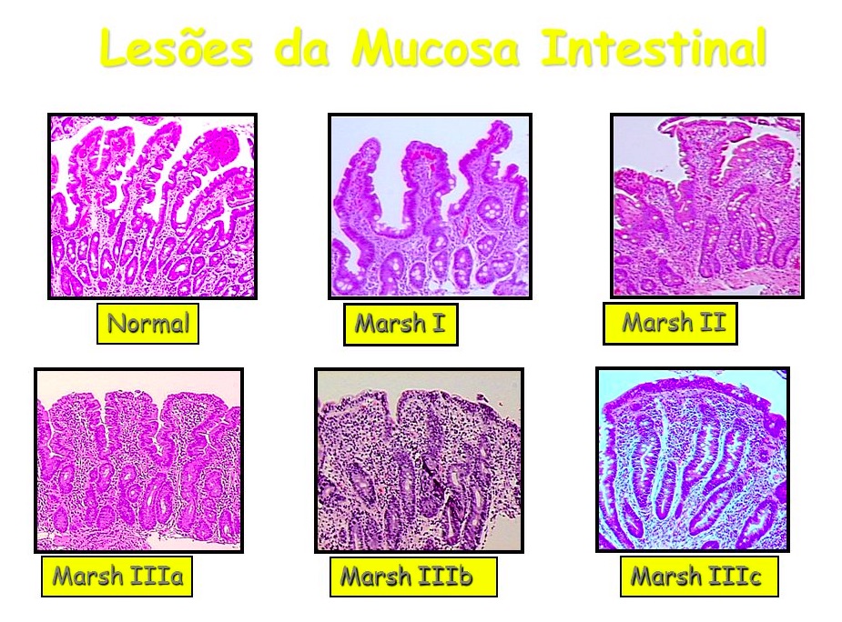 intestino.jpg